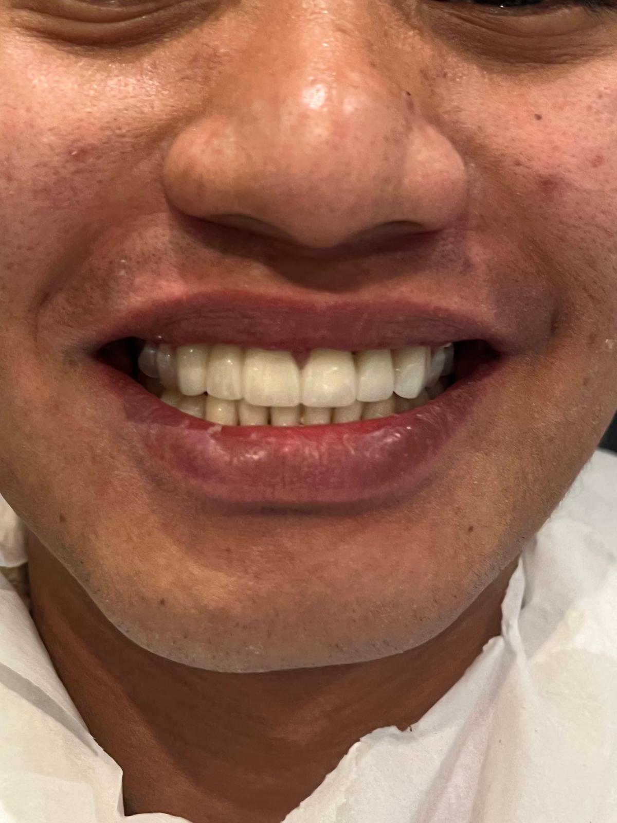 ECE Dental Patient Transformation